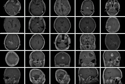 Twenty-five brain MRI slices from the training set, axial and coronal, some showing a visible mass and some clear.